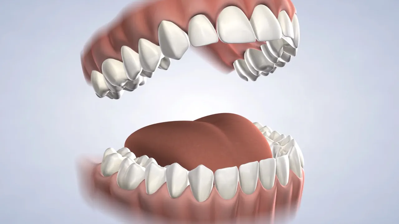 Set of teeth