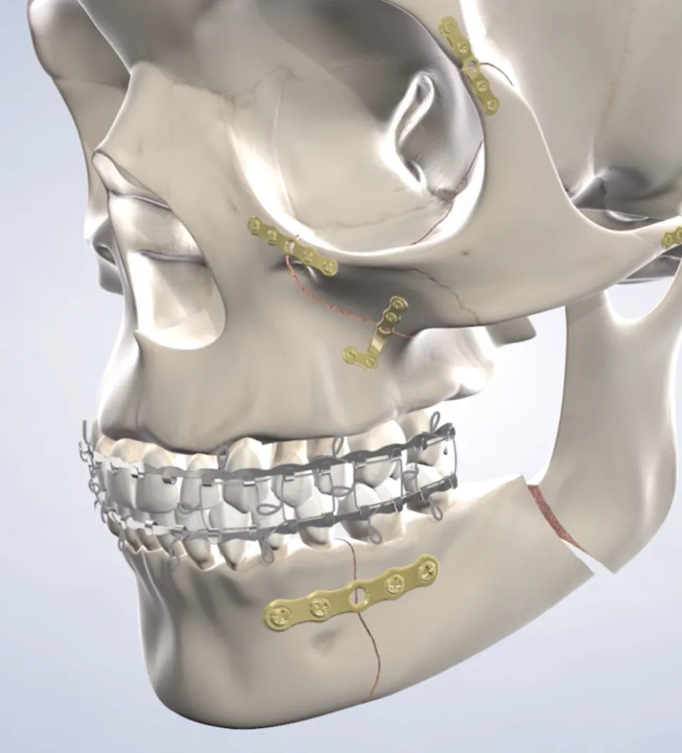 Procedure query page facial trauma