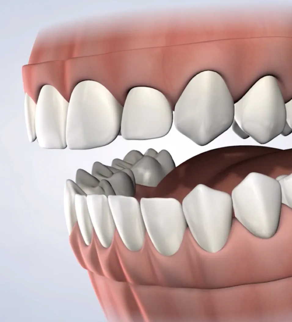 Procedure query page pre prosthetic surgery
